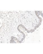 Anti-GRHL1 Antibody, Rabbit Polyclonal sinobiological 202374-T08