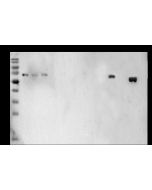 Influenza A H1N1 (Swine Flu 2009) Neuraminidase / NA Antibody, Rabbit MAb sinobiological 11058-R001