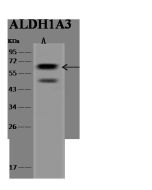Anti-ALDH1A3 Antibody, Rabbit Polyclonal sinobiological 201940-T34