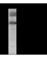 Anti-HGF Antibody, Rabbit Polyclonal sinobiological 10463-T20