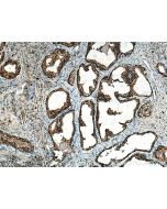 CAPG Polyclonal antibody 10194-1-AP proteintech