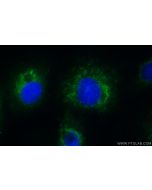 ACOX1 Polyclonal antibody 10957-1-AP proteintech