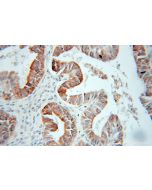 HSD17B2 Polyclonal antibody 10978-1-AP proteintech
