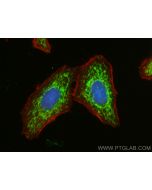 FDX1 Polyclonal antibody 12592-1-AP proteintech