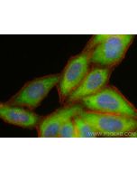 CaMKII Gamma Polyclonal antibody 12666-2-AP proteintech