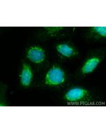 BNIP3L Polyclonal antibody 12986-1-AP proteintech