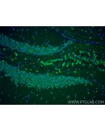 EGR2 Polyclonal antibody 13491-1-AP proteintech