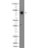 CD80 Polyclonal antibody 14292-1-AP proteintech