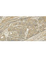 CHAC1 Polyclonal antibody 15207-1-AP proteintech
