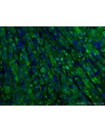Arginase-1 Polyclonal antibody 16001-1-AP proteintech