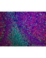 CD3 Polyclonal antibody 17617-1-AP proteintech