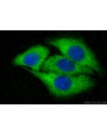 CYP7A1 Polyclonal antibody 18054-1-AP proteintech