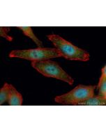 GLI2-Specific Polyclonal antibody 18989-1-AP proteintech
