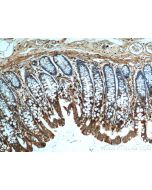 FFAR2 Polyclonal antibody 19952-1-AP proteintech