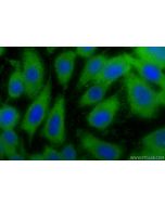ARF6-Specific Polyclonal antibody 20225-1-AP proteintech