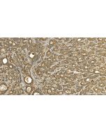 ACSL3 Polyclonal antibody 20710-1-AP proteintech