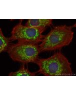 CHCHD4 Polyclonal antibody 21090-1-AP proteintech