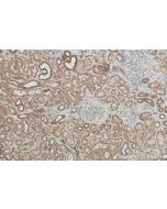 FOXO4 Polyclonal antibody 21535-1-AP proteintech