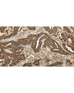 CD107a / LAMP1 Polyclonal antibody 21997-1-AP proteintech