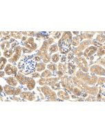 MCU/CCDC109A Polyclonal antibody 26312-1-AP proteintech