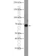 ABCG5 Polyclonal antibody 27722-1-AP proteintech