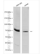 FOXC1 Polyclonal antibody 30082-1-AP proteintech
