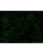 CDC25A Polyclonal antibody 55031-1-AP proteintech