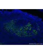 CD23 Monoclonal antibody 60208-1-Ig proteintech