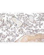 CD71 Monoclonal antibody 65236-1-Ig proteintech