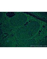 ARHGDIB Monoclonal antibody 66054-1-Ig proteintech