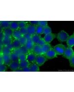Pancreatic alpha-amylase Monoclonal antibody 66133-1-Ig proteintech