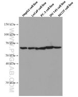 HYAL1 Monoclonal antibody 66560-1-Ig proteintech