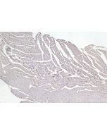 CYP1B1 Monoclonal antibody 67033-1-Ig proteintech