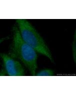 ATG9A Monoclonal antibody 67096-1-Ig proteintech