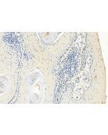 FANCI Monoclonal antibody 67304-1-Ig proteintech