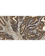 ASC/TMS1 Monoclonal antibody 67494-1-Ig proteintech