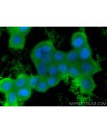 AKR1B1 Monoclonal antibody 67498-1-Ig proteintech