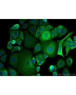 CCT8 Monoclonal antibody 67539-1-Ig proteintech