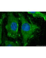 BAD Monoclonal antibody 67830-1-Ig proteintech