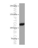 EMCN Monoclonal antibody 67854-1-Ig proteintech