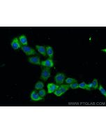 ADC Monoclonal antibody 67884-1-Ig proteintech