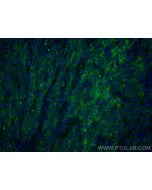 Cytokeratin 5/6 Monoclonal antibody 68295-1-Ig proteintech