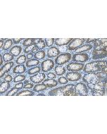 HSP70 Recombinant monoclonal antibody 80735-1-RR proteintech