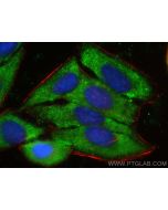ATG7 Recombinant monoclonal antibody 81760-1-RR proteintech