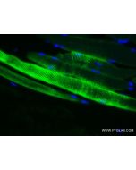 ACTA1-Specific Recombinant monoclonal antibody 82714-5-RR proteintech