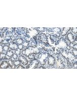 ARID1A Recombinant monoclonal antibody 83733-3-RR proteintech