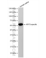 Cytokeratin 3 Recombinant monoclonal antibody 84042-1-RR proteintech