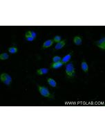 ABCC5 Recombinant monoclonal antibody 84204-5-RR proteintech
